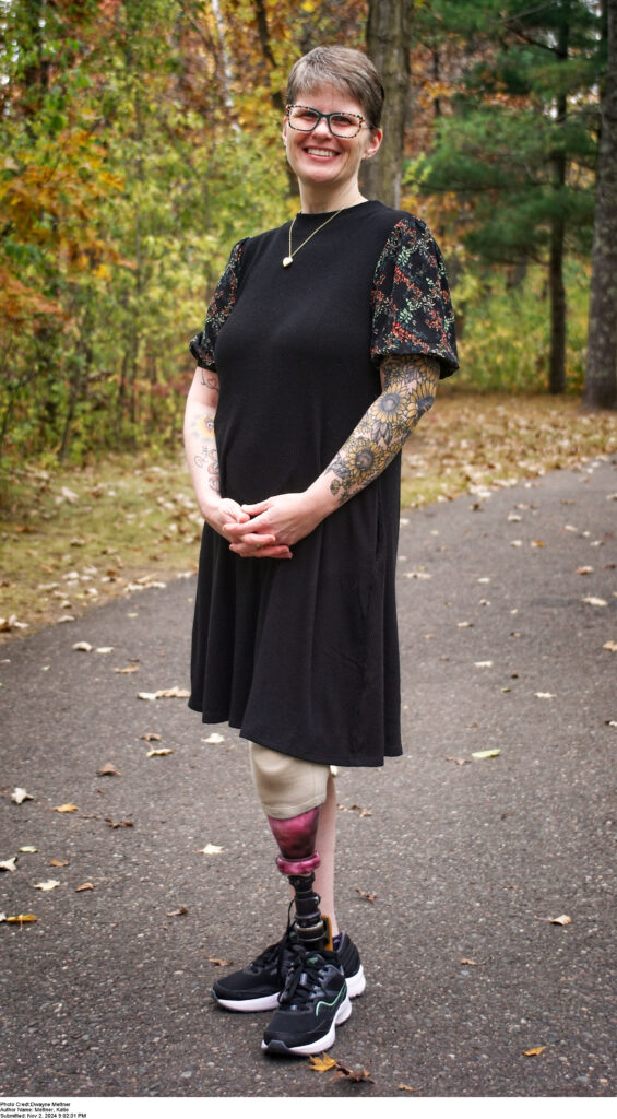 Author Katie Mettner stands in a black dress in front of some autumn trees. Her left leg is a prosthetic. 